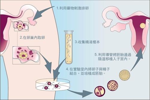 2021年重庆试管婴儿医院排名